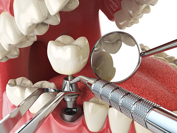 Best Emergency Dental Care for Abscessed Tooth in Hot Springs, AR